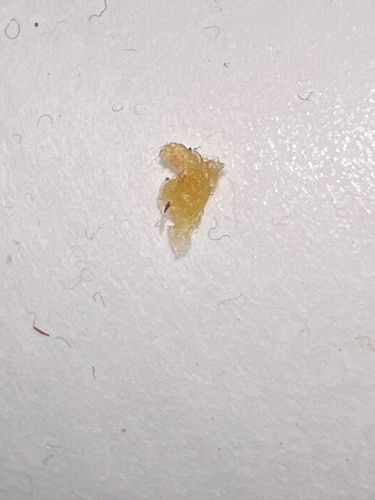 Inconclusive (Likely debris or biological material)