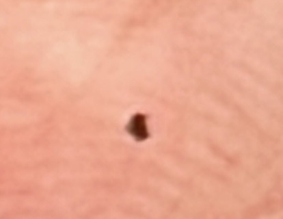 Tick