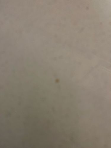 Unidentifiable stain