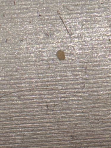 Mite (likely an orb/oval-shaped mite egg or a very small mite)