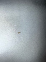 Unidentifiable insect/particle