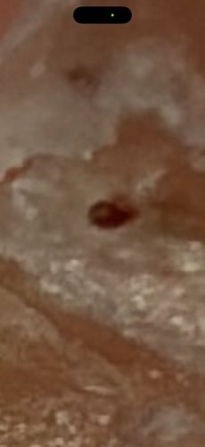 Bed Bug