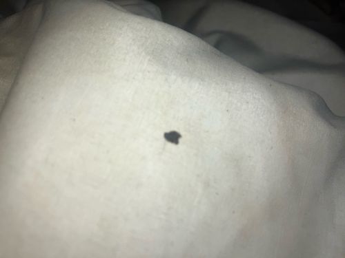 Unidentifiable insect/debris