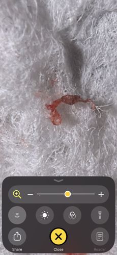 Bed Bug