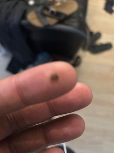 Tick (likely a common species such as a Deer Tick or Dog Tick, but difficult to determine exact species from image alone)