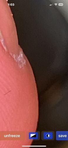 Unidentifiable insect/debris