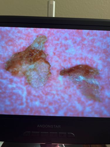 Unidentifiable organic material