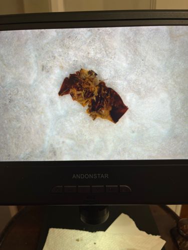 Unidentifiable organic material