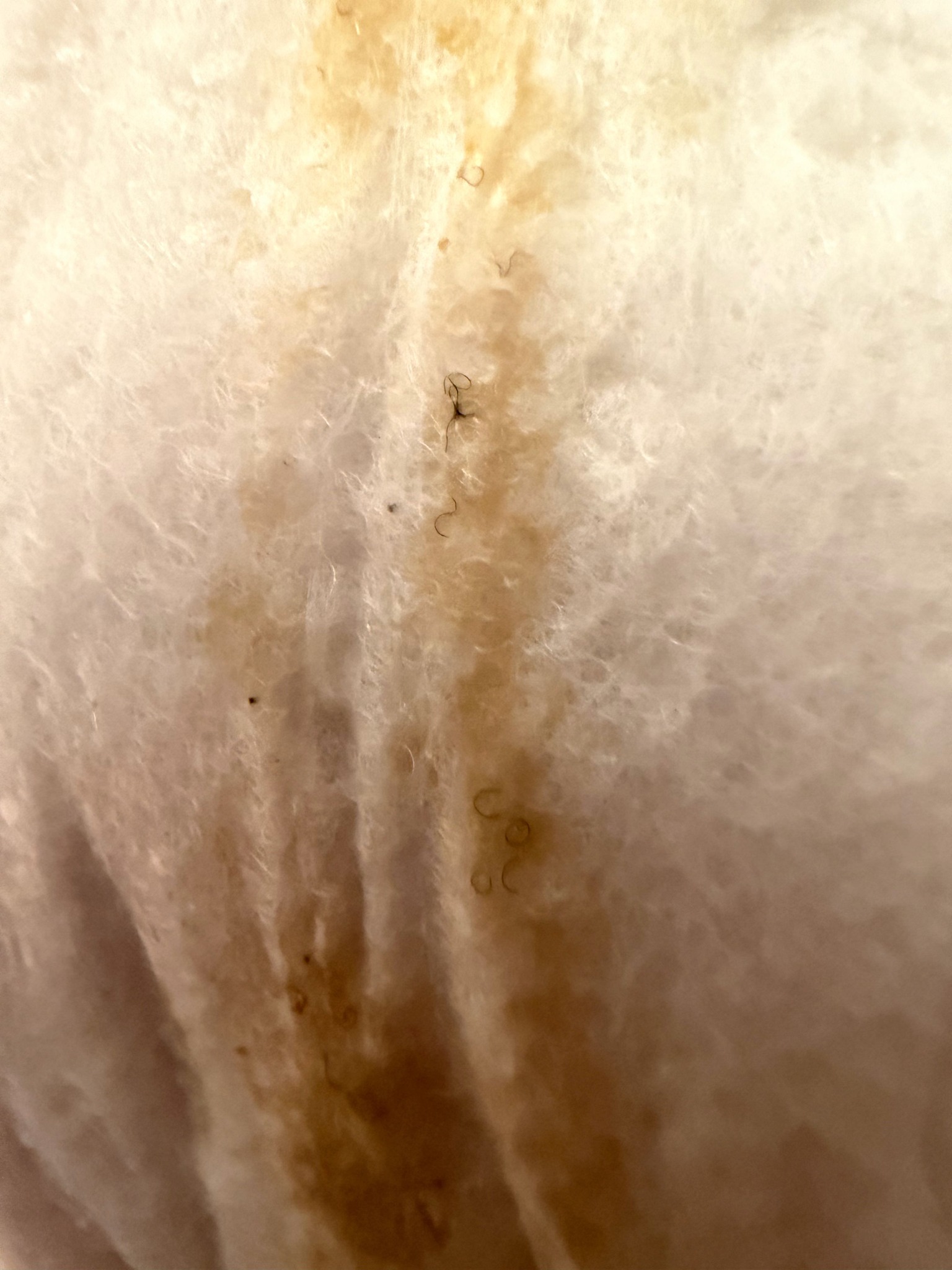 Pubic Louse