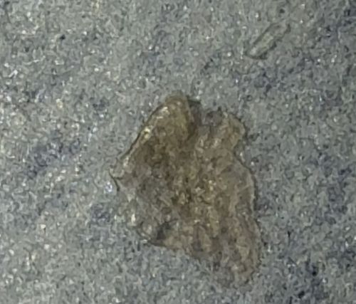 Non-insect Debris (Likely skin flake or scab)