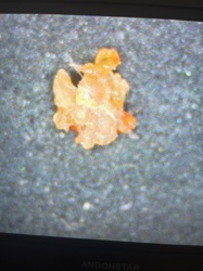 Unidentifiable organic/biological material