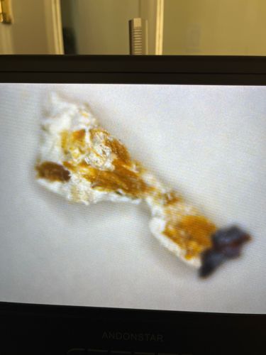 It is not possible to identify an insect from the provided image.