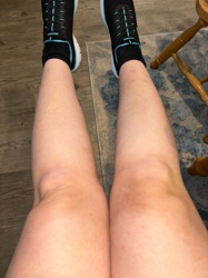 No insect or bug identifiable