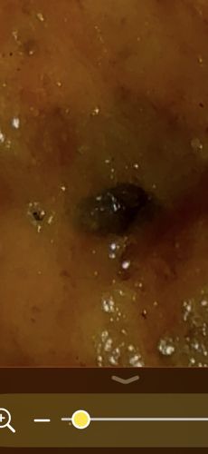 Ant