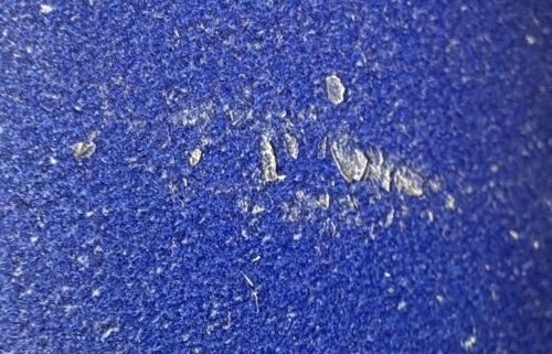 Human Skin Scales (Commonly confused for Skin Mites/Scabies)