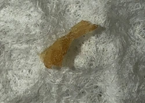 Earwax (Cerumen) / Not an organism