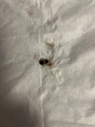 Carpet Beetle (likely Varied Carpet Beetle or Black Carpet Beetle)