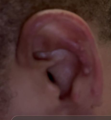 Earwig