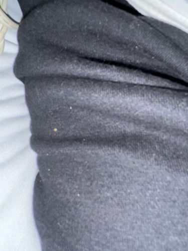 Carpet Beetle larvae (or similar dermestid beetle larvae)