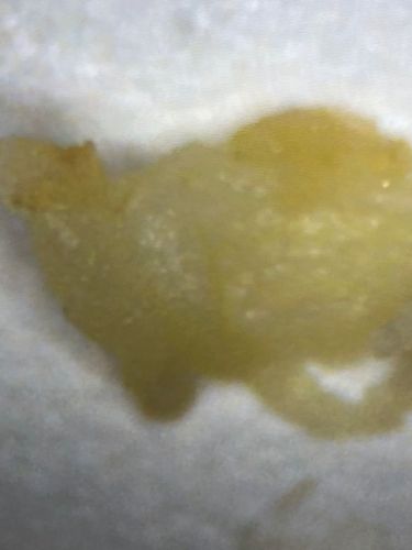 Unidentifiable organic matter