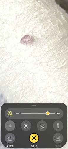 Inconclusive (Requires clearer image)