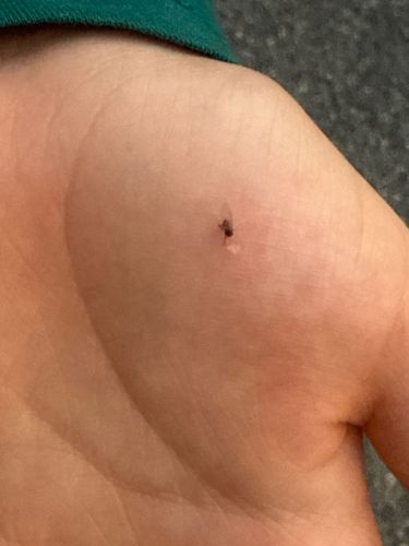 Biting Midge (or 'No-see-um', 'Punkie')