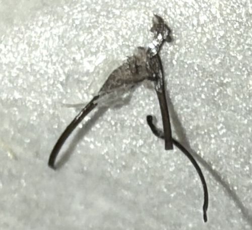 Non-insect Artifact (Likely Scab or Skin Flake with Hair)