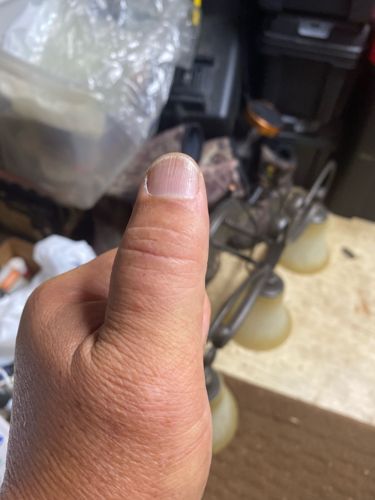 Not Applicable - No insect visible