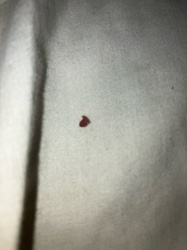 Unidentifiable insect remains/blood stain