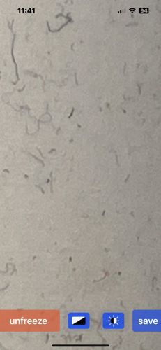 Threadworm (Human or animal depending on species)