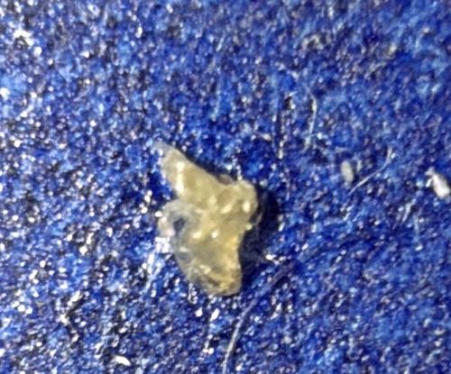 There is no insect in this image.