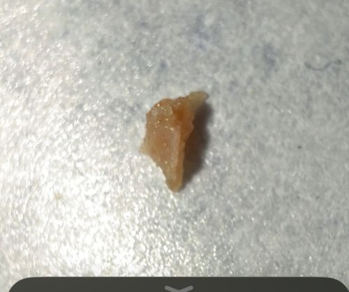 Inconclusive (Non-biological material)