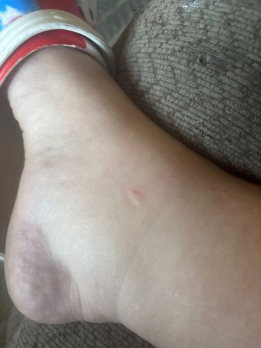 No insect or bug is visible in the image