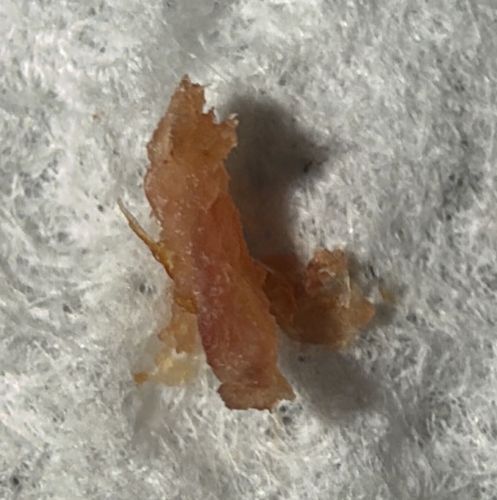 Not a bug (likely biological debris or scab)