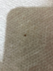 Lone Star Tick