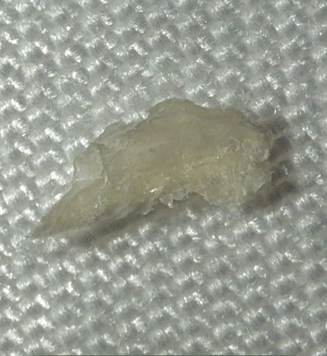 Non-Biological Material (Likely Fabric or Household Debris)