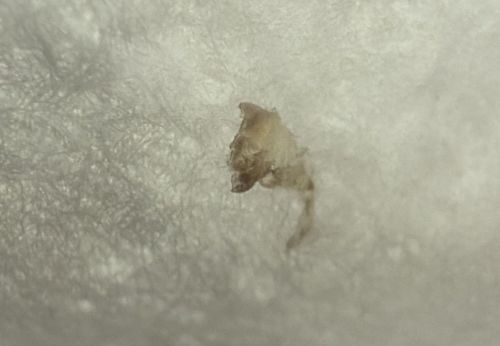 Louse Nit or Head Louse Casing (likely)