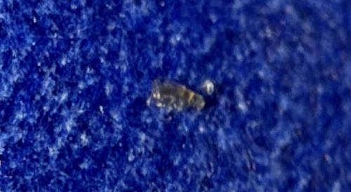 Body Louse (or possibly Head Louse)