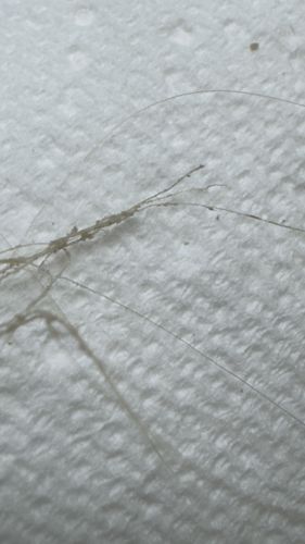 Body Louse (Nits/Eggs on hair)