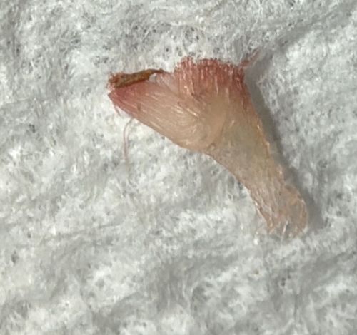 None (Plant Material / Bud Scale)