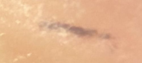 Unknown/Unidentifiable (Likely Dust, Lint, or Smudge)