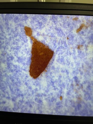 Unidentifiable Particle (likely not an insect)