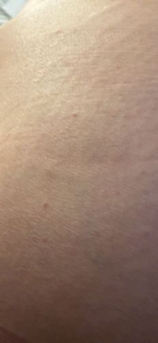 Undetermined; Human skin with potential small bumps/irritations