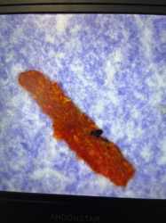 Unidentifiable organic material