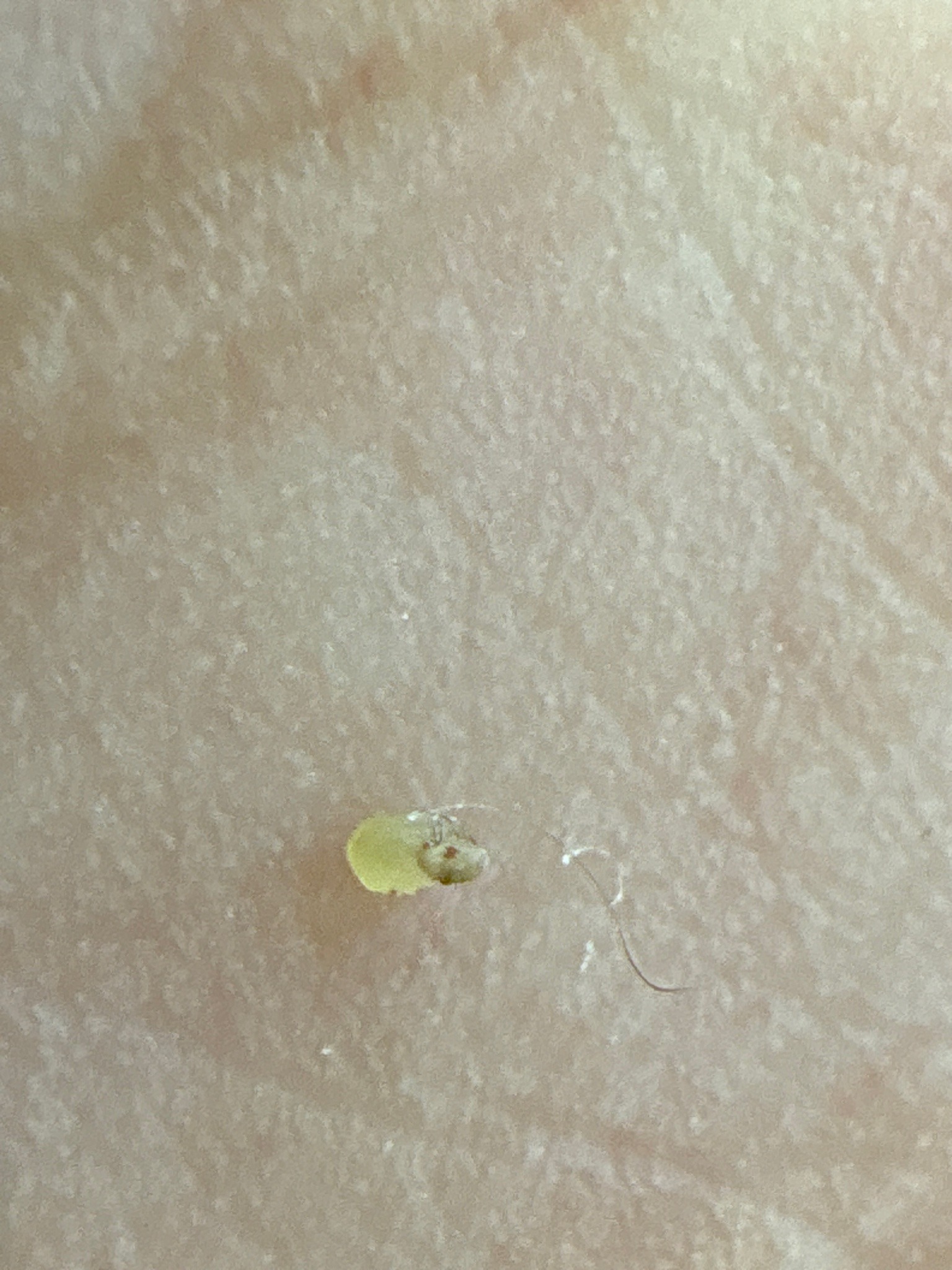 Aphid