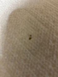 Unidentifiable due to image quality