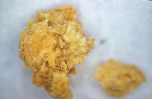 Not Applicable (These are inanimate objects)