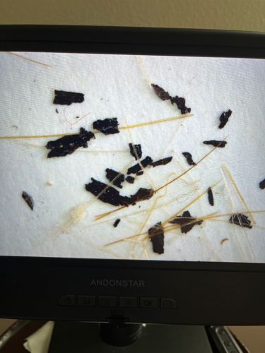 Flea (excrement/flea dirt)