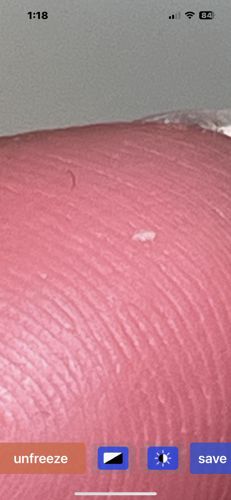 It is not possible to identify an insect from the provided image.