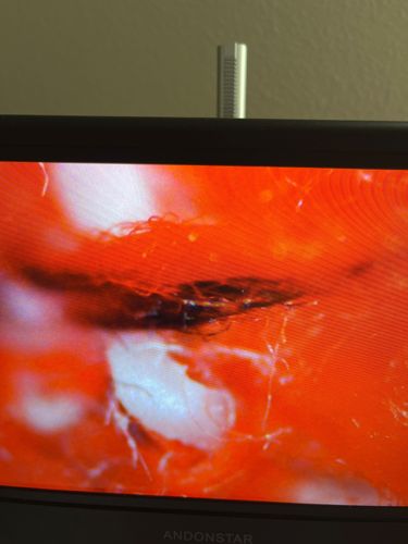 Mold Mites / Dust Mites (General Identification)